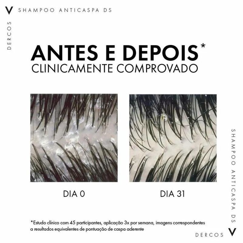 vichy-dercos-shampoo-ds-anticaspa-intensivo-refil-200g-10039518