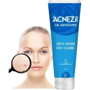 Acnezi Gel 80g Esfoliante Cimed