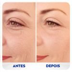 preenchedor-q10-expert-antissinais-nivea-15ml-10042904