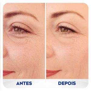Preenchedor Q10 Expert Antissinais Nivea 15ml