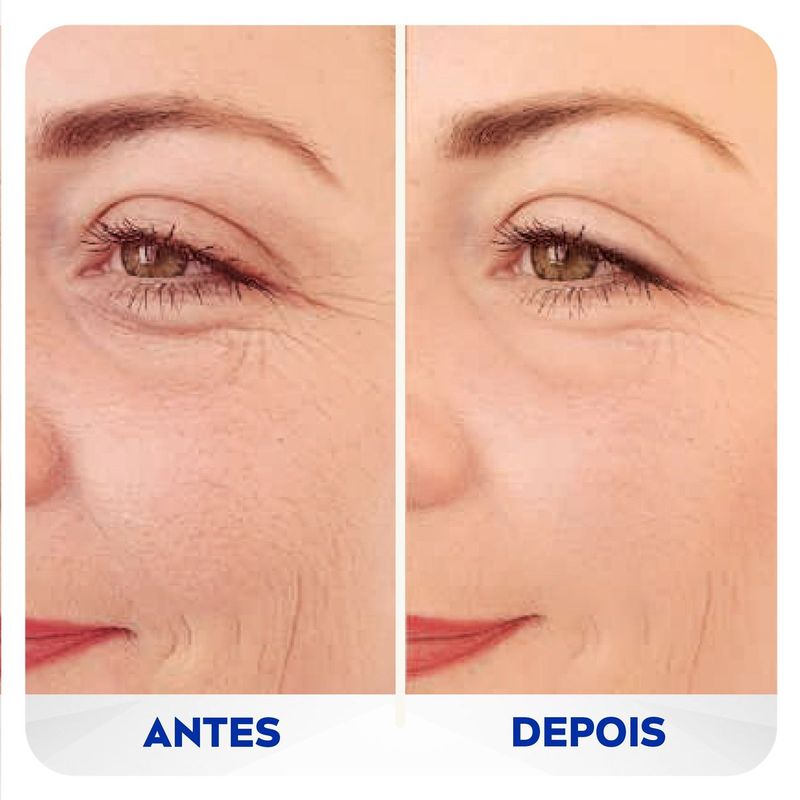 preenchedor-q10-expert-antissinais-nivea-15ml-10042904