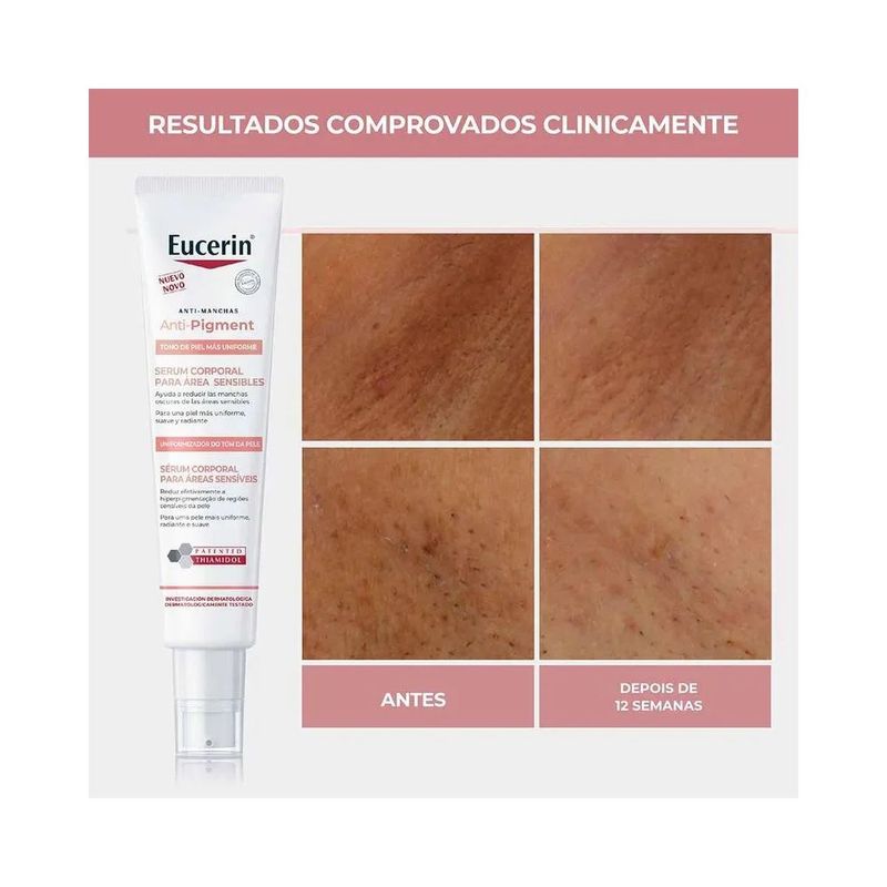 eucerin-anti-pigment-serum-corporal-areas-sensiveis-75ml-10043762