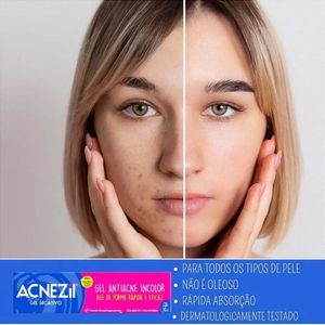 Gel Secativo para Acne Acnezil Incolor 10g