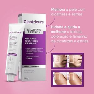 Gel para Cicatrizes e Estrias Cicatricure 30g